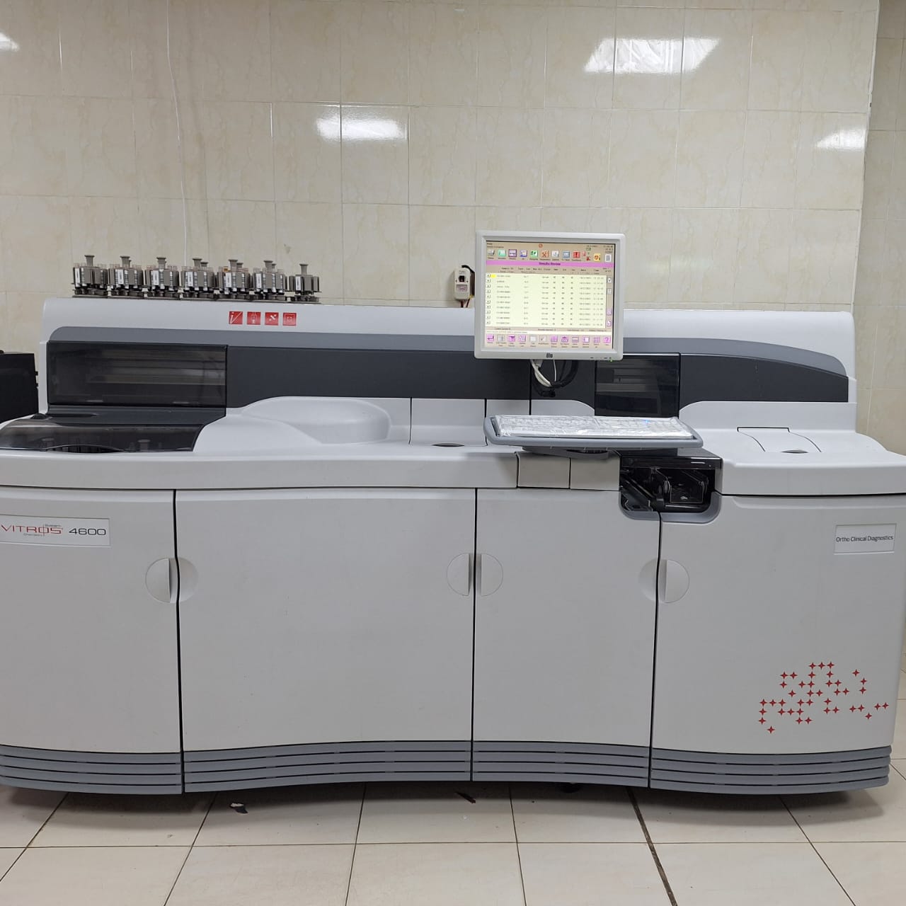 automated clinical chemistry